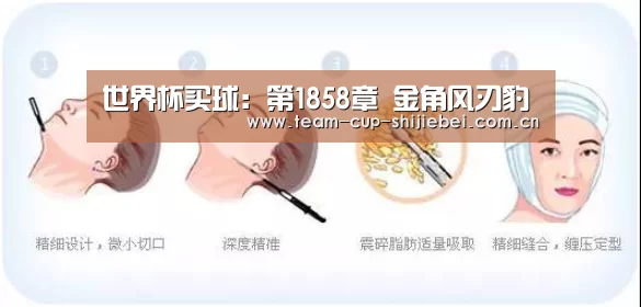世界杯投注站